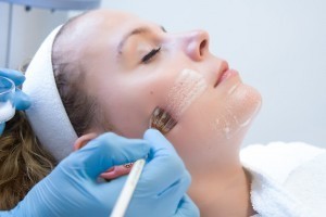 Acne peeling Katwijk aan Zee