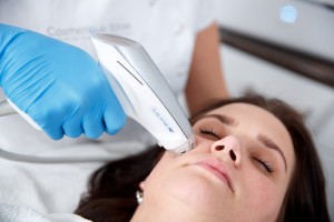 acne laserbehandeling